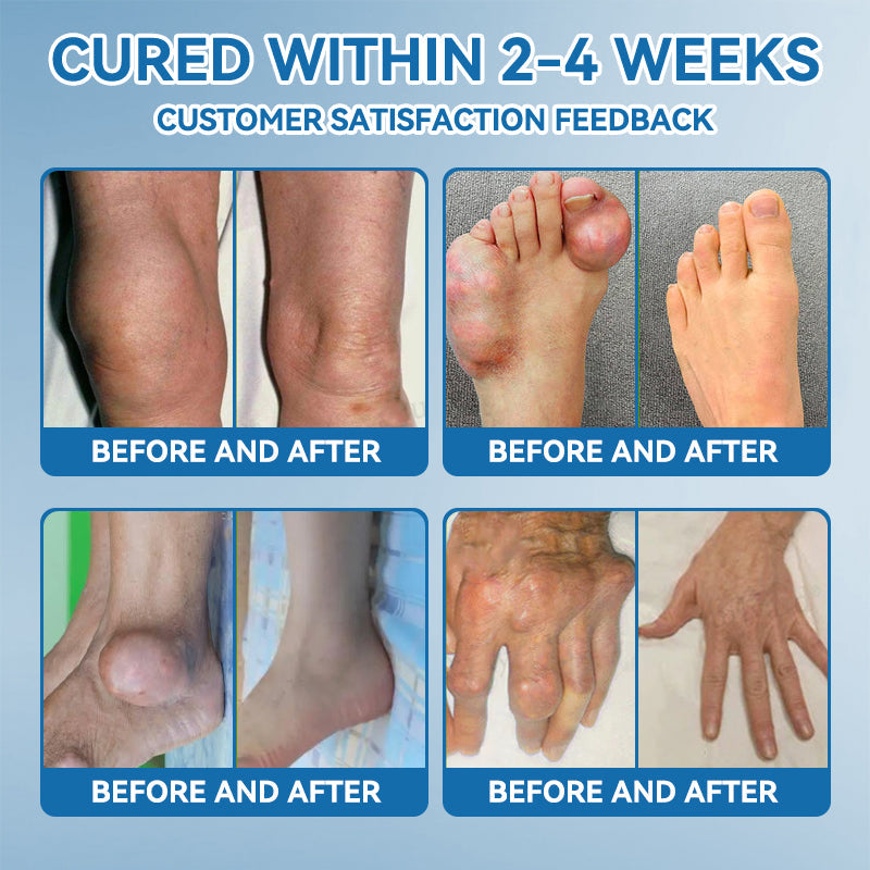 💧𝖯𝗂𝖼𝗱𝗼® BPC-157 Joint Healing Cream🦴Treats Arthritis, Neuropathy, Rheumatism, Sports Injuries & More💥