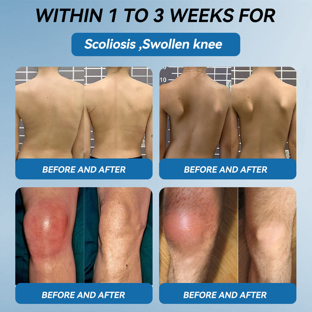 💧𝖯𝗂𝖼𝗱𝗼® BPC-157 Joint Healing Cream🦴Treats Arthritis, Neuropathy, Rheumatism, Sports Injuries & More💥