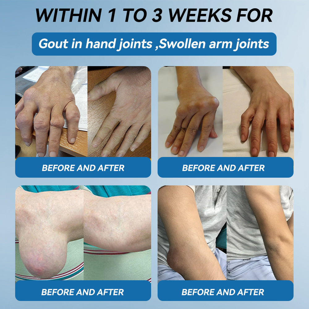 💧𝖯𝗂𝖼𝗱𝗼® BPC-157 Joint Healing Cream🦴Treats Arthritis, Neuropathy, Rheumatism, Sports Injuries & More💥