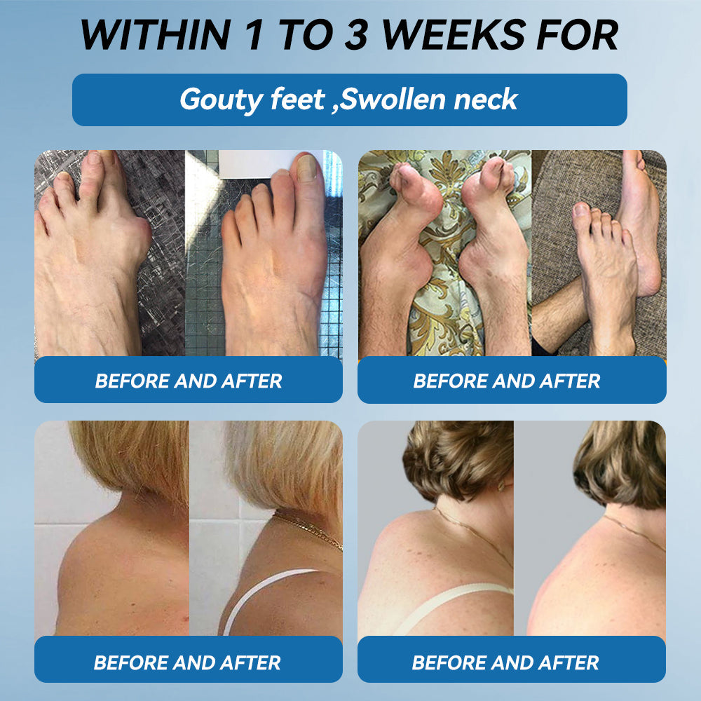 💧𝖯𝗂𝖼𝗱𝗼® BPC-157 Joint Healing Cream🦴Treats Arthritis, Neuropathy, Rheumatism, Sports Injuries & More💥