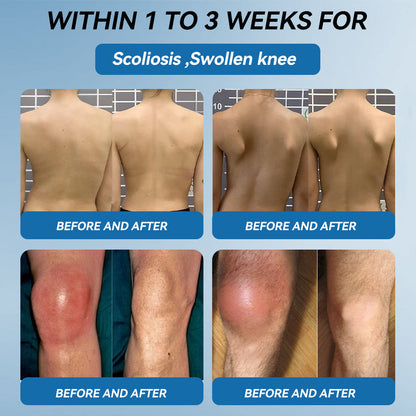 💧𝖯𝗂𝖼𝗱𝗼® BPC-157 Joint Healing Cream🦴Treats Arthritis, Neuropathy, Rheumatism, Sports Injuries & More💥